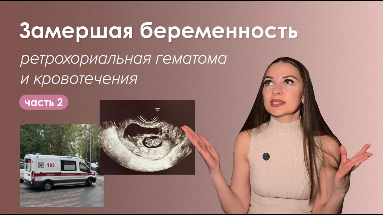 История моей замершей беременности (часть 2). Ретрохориальная гематома и кровотечения