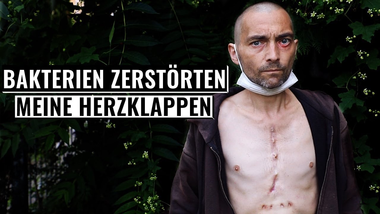 ICH habe zwei neue HERZKLAPPEN I Frankfurt Bahnhofsviertel