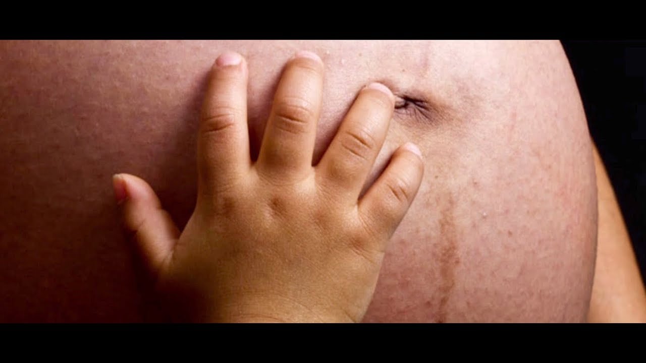 Why are black mothers and infants far more likely to die in U.S. from pregnancy-related causes?