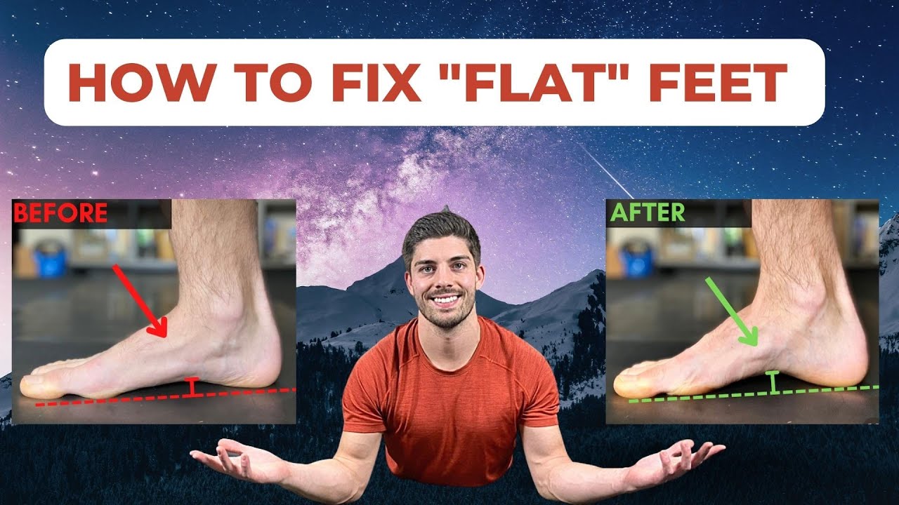 How to FIX flat feet in 5 minutes per day (FOLLOW ALONG) to ease plantar fasciitis and foot pain