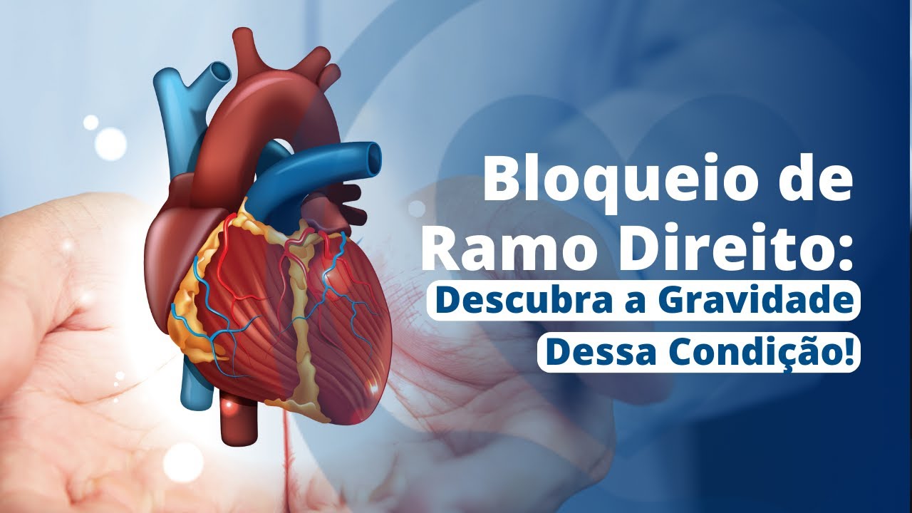 Você Tem Bloqueio de Ramo Direito? Saiba os Riscos e Como Tratar!