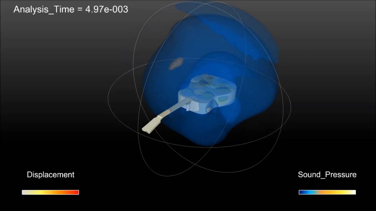 Transient vibro-acoustic simulation of a YAMAHA guitar using time-stable model order reduction