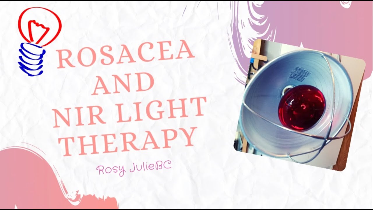 Near Infrared Light Therapy for Rosaces for the First Time| Rosy JulieBC