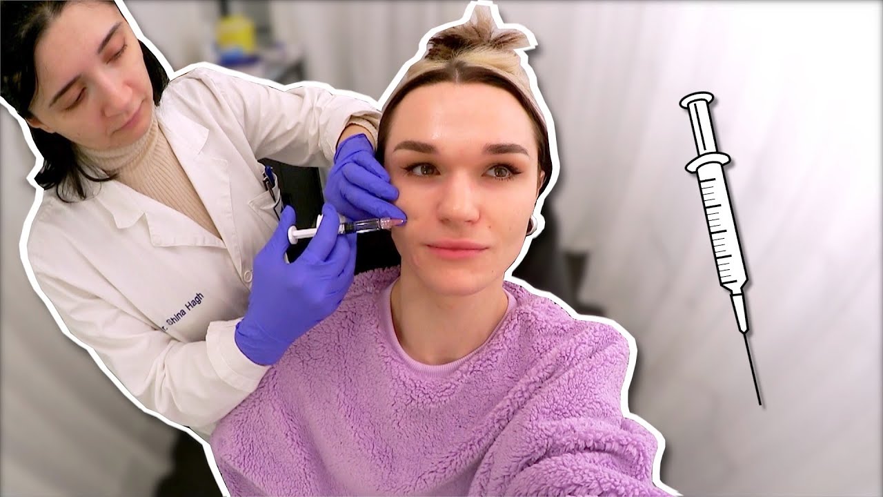 GÖR FILLERS FÖR FÖRSTA GÅNGEN | Vlogg