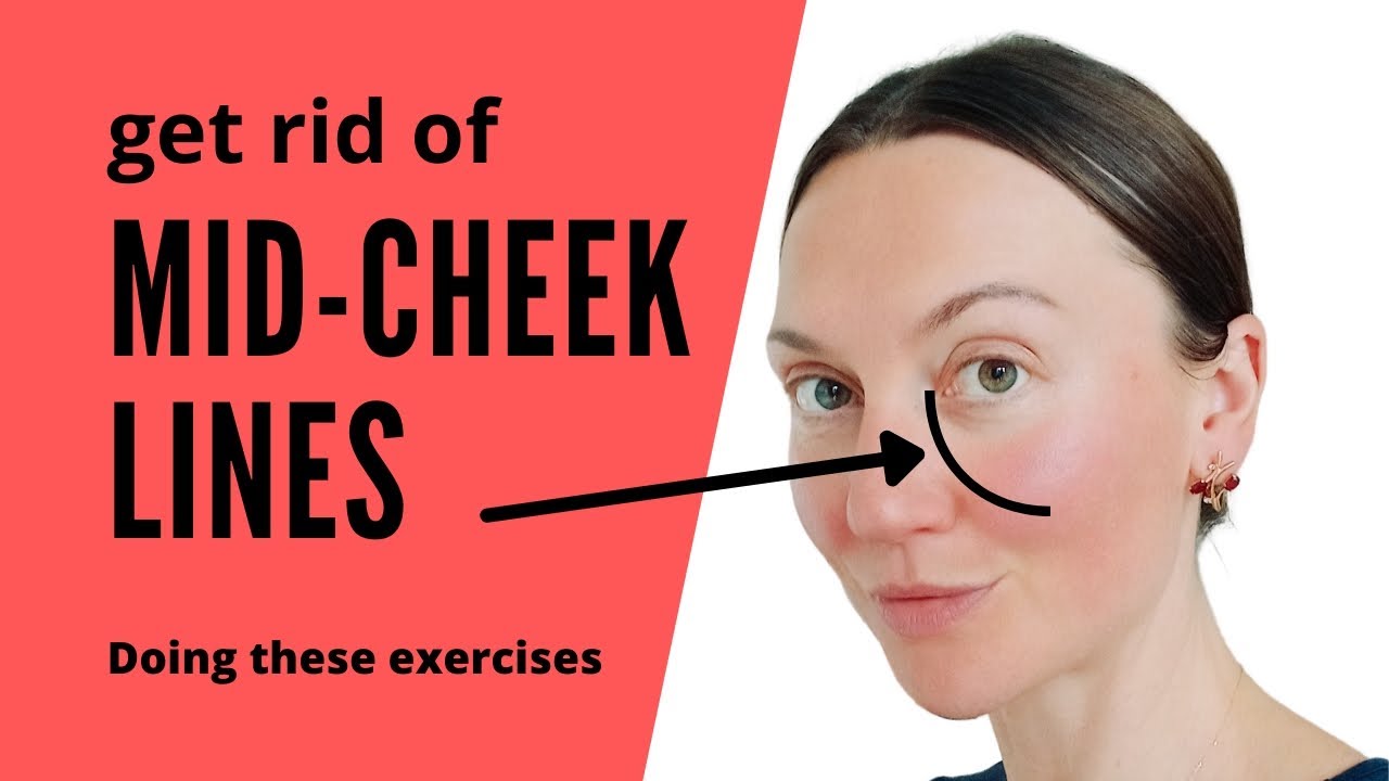 Mid-cheek lines. Face Yoga exercises. Reasons & solution to reduce and prevent mid-cheek lines.