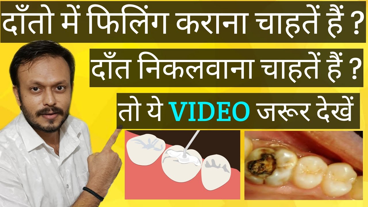 Confuse about dental fillings ? Dental fillings कराना कब safe होता है || Dr.Vaibhav Tiwari