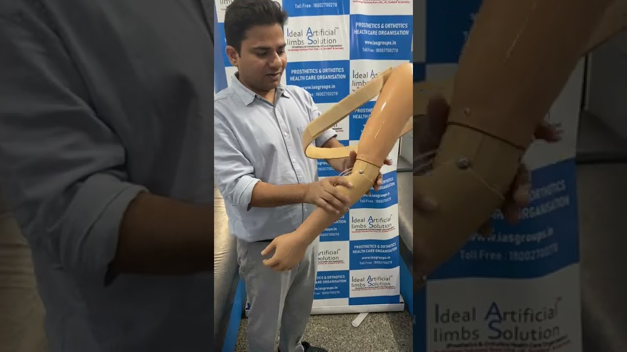 Nakli hath l Cosmatic hand l Cosmetic above elbow prosthesis,  कॉस्मेटिक , कृत्रिम अंग