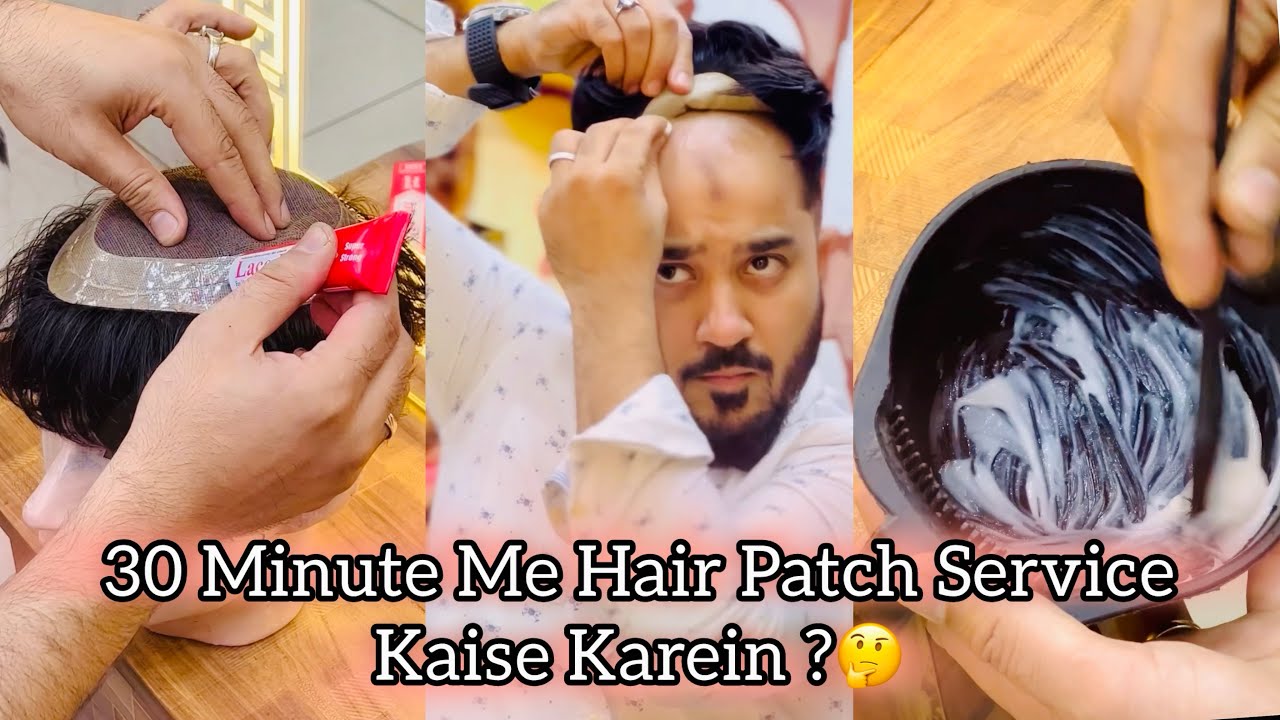 Khud Se Hair Patch Service Kaise Karein ? | Permanent Hair Patch Delhi | Hair Patch For Mens