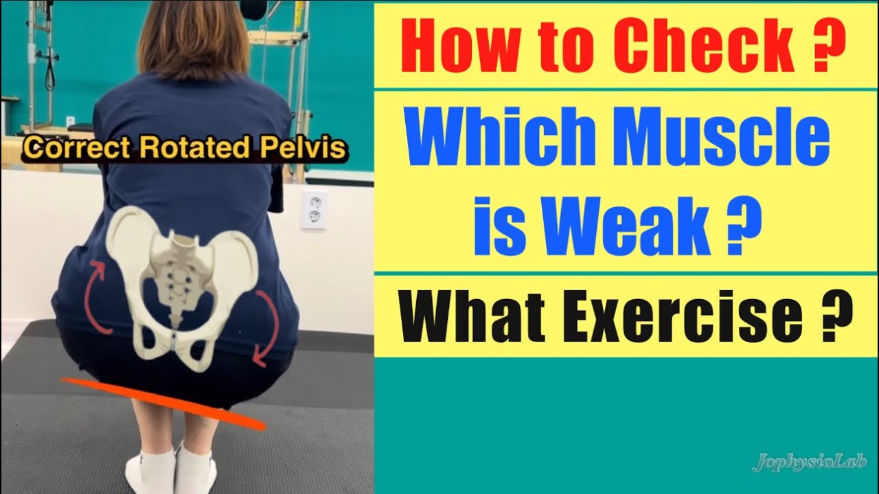 Fix Pelvic Torsion. Correct Rotated Pelvis with Exercise. 