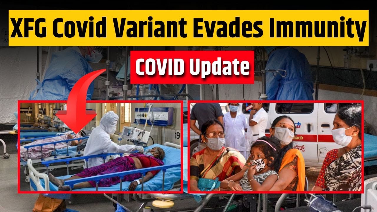 Covid 19 Update: What Makes XFG Variant So Dangerous?