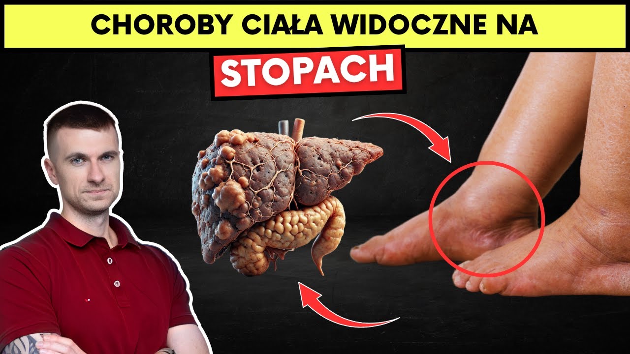 8 oznak ukrytych chorób widocznych na Twoich stopach. Skutecznie je wylecz.