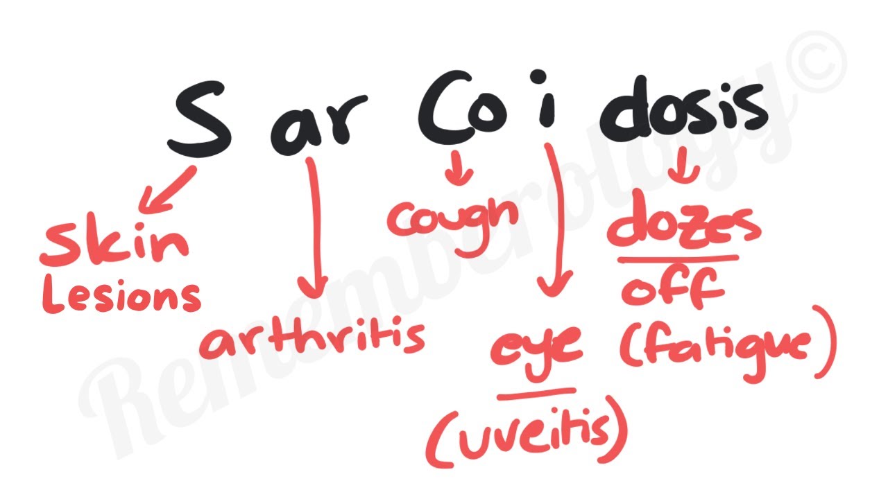 Sarcoidosis Mnemonics | INBDE Oral Pathology Mnemonics | Rememberology.net
