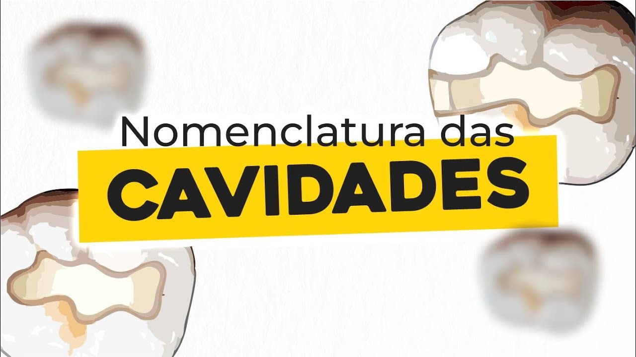 Classificação das cavidades | DENTÍSTICA