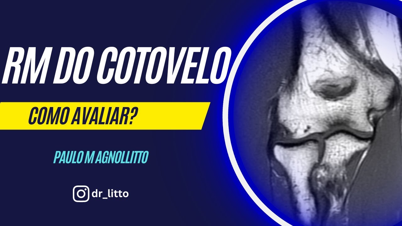 RM DO COTOVELO: COMO AVALIAR?