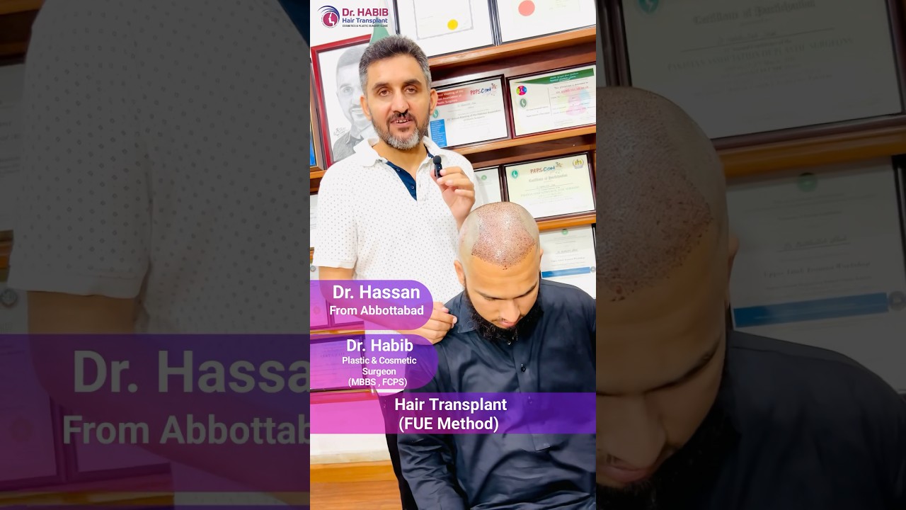 Hair Transplant | FUE Method | Full Head Coverage | 6K Grafts 