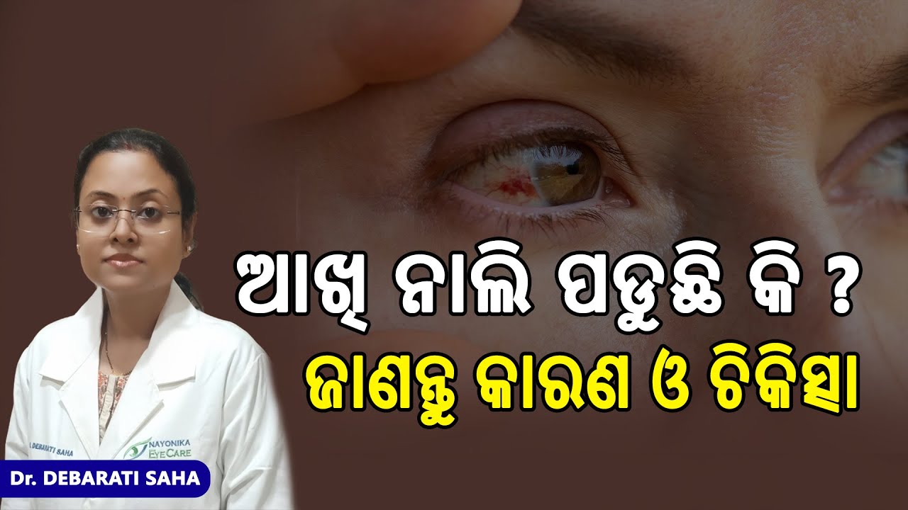 Why Is Your Eye Red? Causes, Symptoms & Treatment Explained by Dr. Debarati Saha