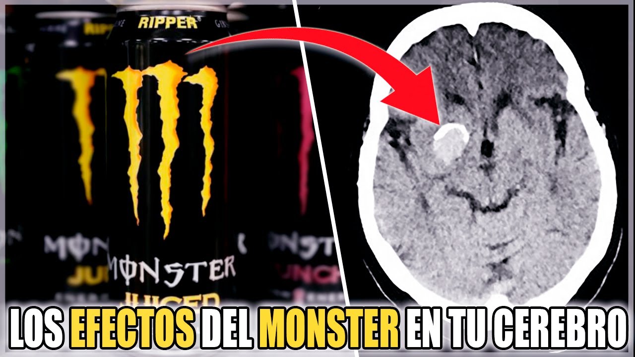 Los EFECTOS de las BEBIDAS ENERGÉTICAS en el CEREBRO ¿SON TAN MALAS?
