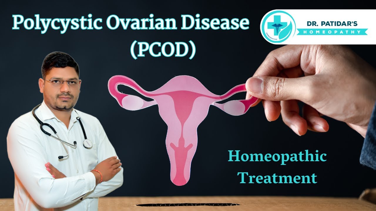 PCOD Homeopathic Treatment | Causes, Symptoms & Medicines | Dr. Sunil Patidar #pcod