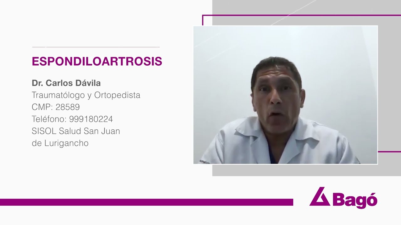 ESPONDILOARTROSIS: ARTROSIS DE LA COLUMNA VERTEBRAL QUE DESGASTA EL CART&Iacute;LAGO DE LAS V&Eacute;RTEBRAS