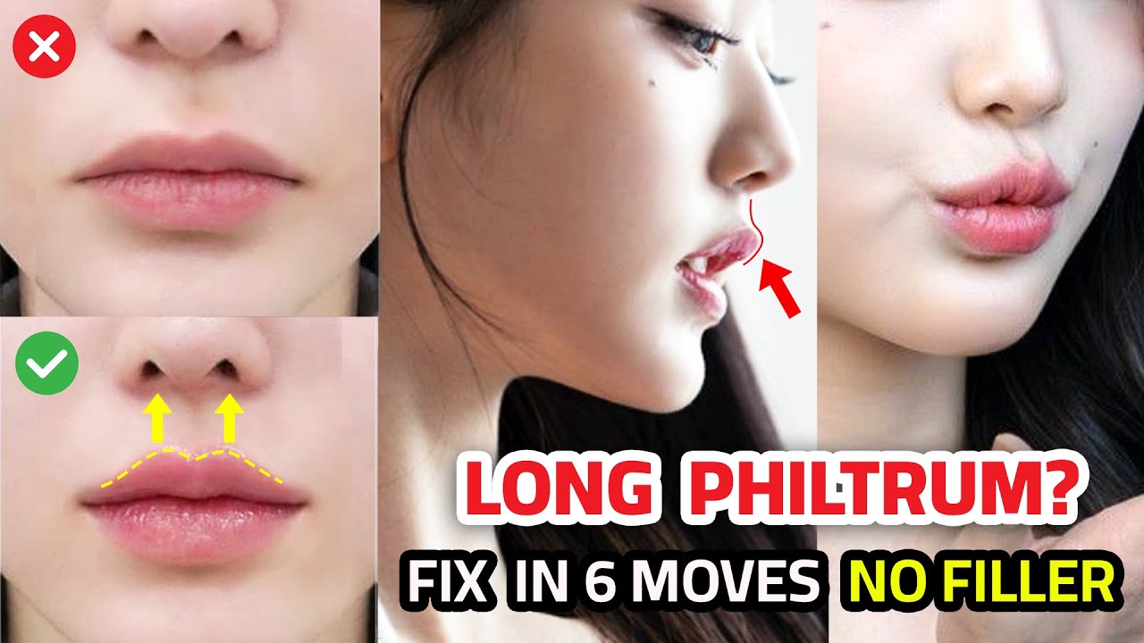 Get K-Idol "Baby Face" Ratio 👶 Shorten Philtrum Naturally (No Surgery)