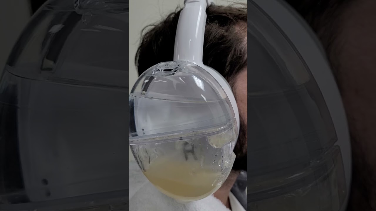 Have you ever experience itchy or painful ears? Removing earwax buildup can alleviate those symptoms