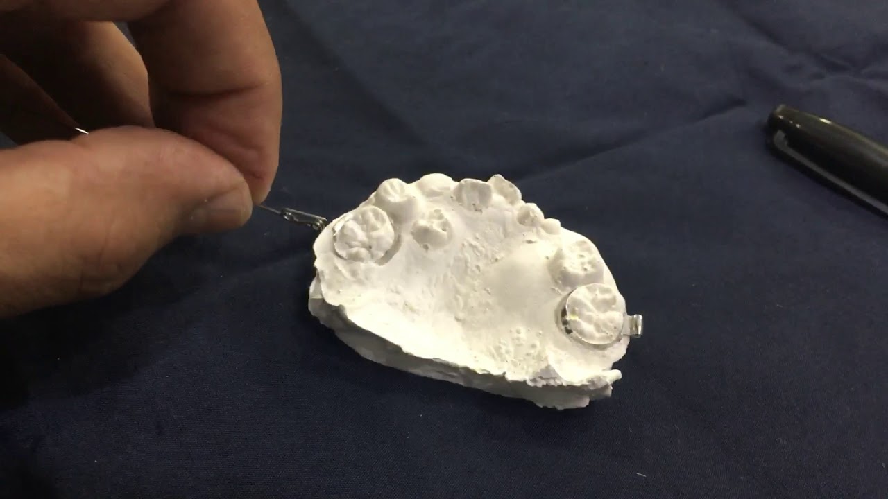 Fabricación de un resorte “z” ortopedia dental