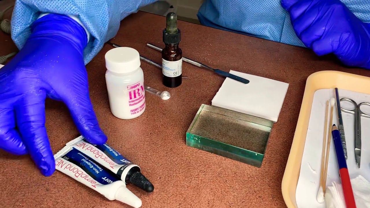 Цементирование временного моста из 3 единиц