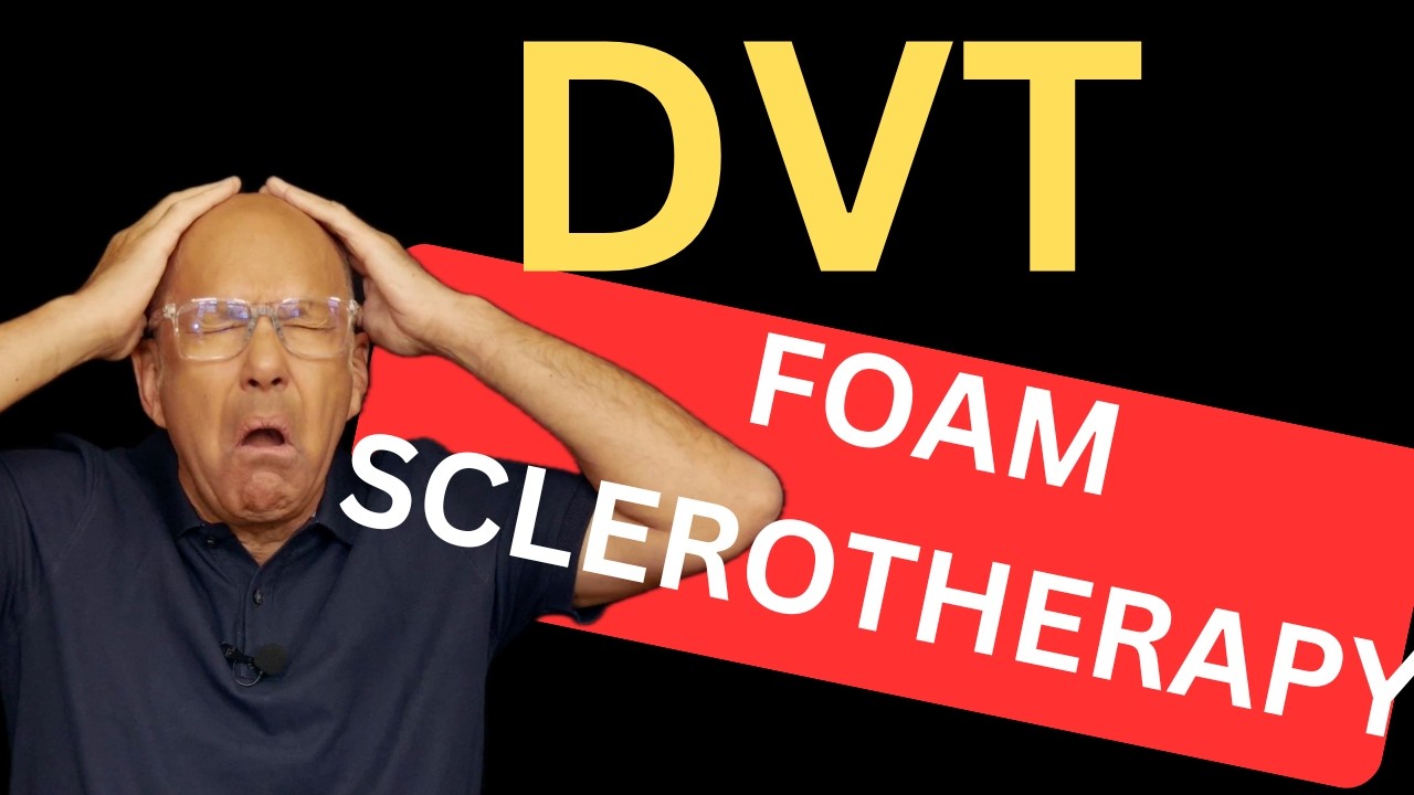 Ultrasound Guided Foam Sclerotherapy & Blood Clots: The Truth About DVT Risk; Facts versus Fiction