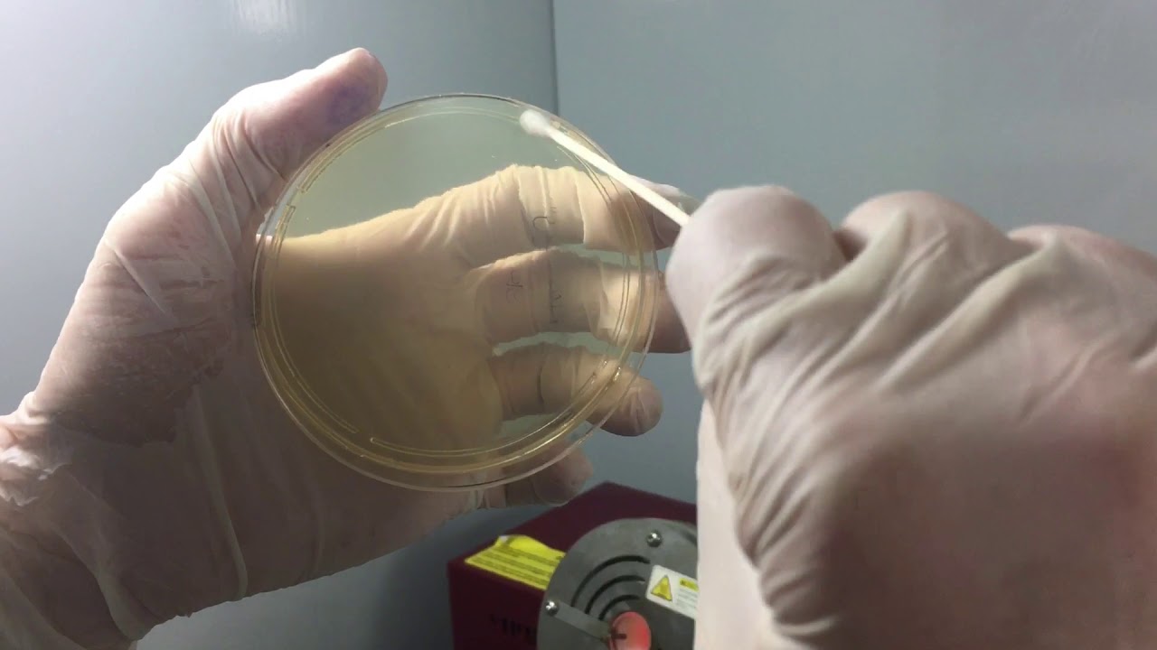 Mikrobiyoloji 🧫 | Kan Kültürü,Gram boyama,kültür ekimi ve antibiyogram
