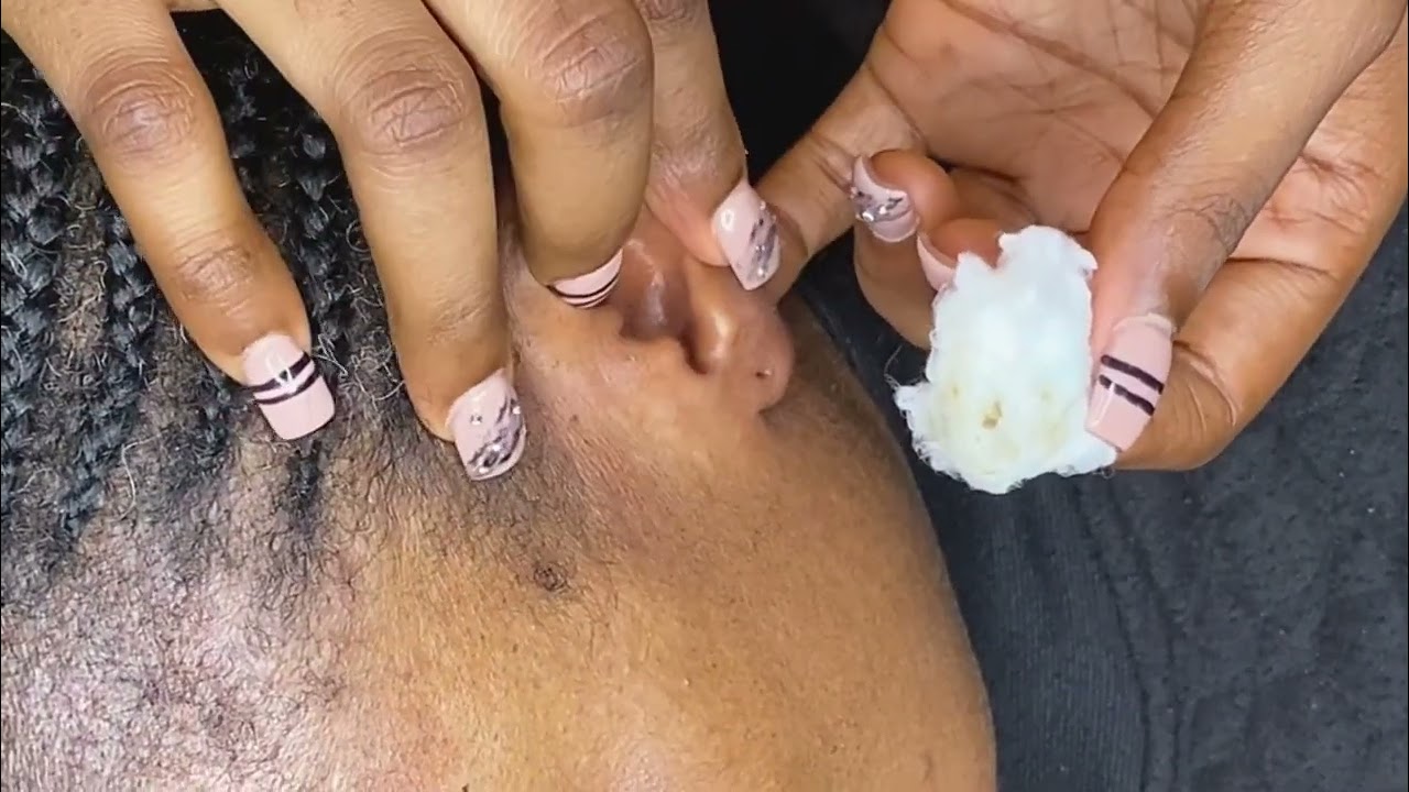 ASMR || EAR CLEANING AND NITPICKING #asmrbubblegum #asmrsounds SLEEP LIKE A BABY #asmrforyou #asmr