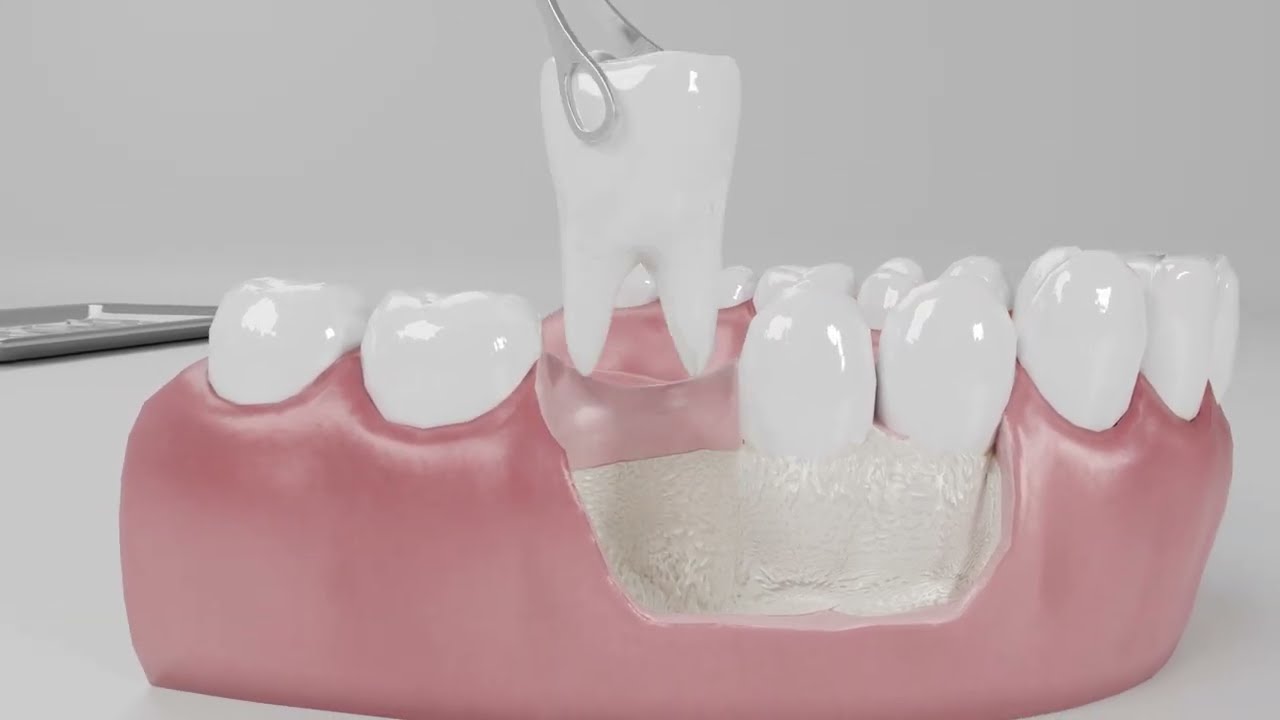 TT Tooth Transformer® – Oficiální návod | Princip fungování