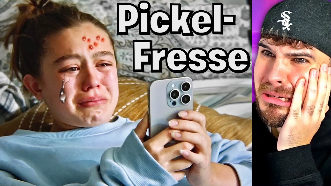 Mädchen wird FERTIG GEMACHT wegen PICKEL