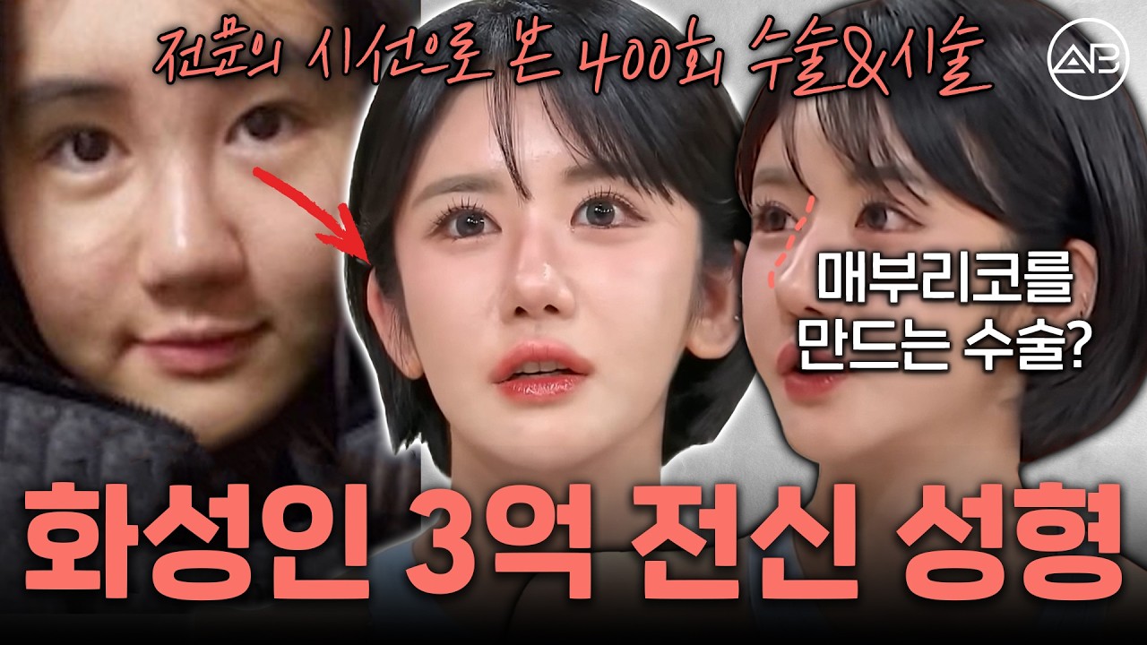 3억 써서 400회 성형한 사람, 괜찮은가요? | 에이비성형외과