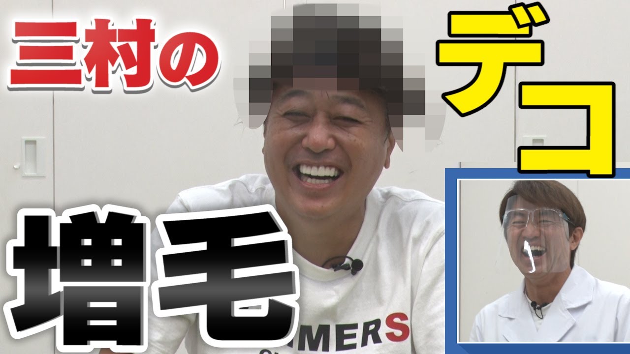 【増毛大作戦】三村のデコをあの頃に戻そう！