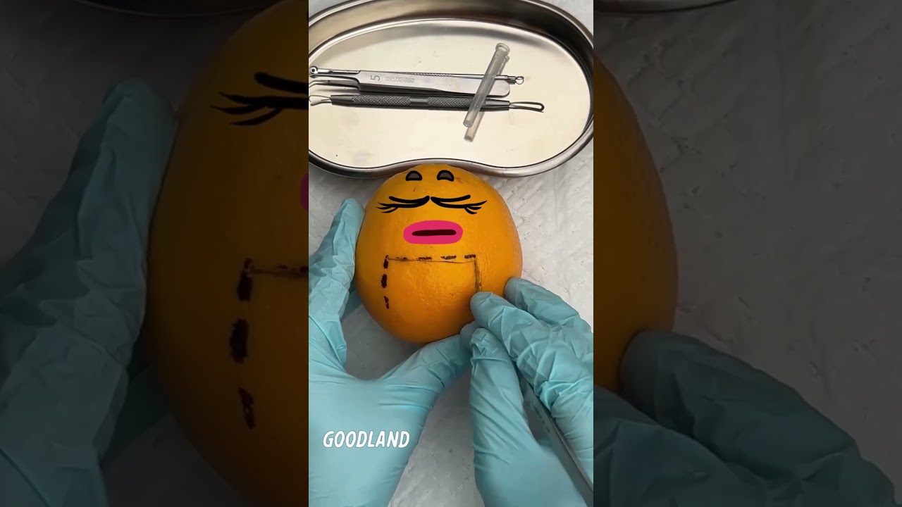 Goodland | Operation on orange#goodland #Fruitsurgery #doodles #doodlesart #goodlandshor #animation