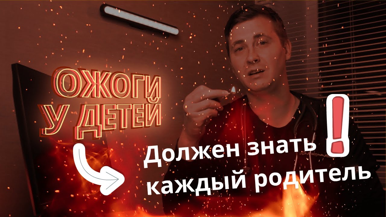 ОЖОГ у ребенка | Первая ПОМОЩЬ при ожоге у малыша | Как УБЕРЕЧЬ ребенка от ОЖОГОВ