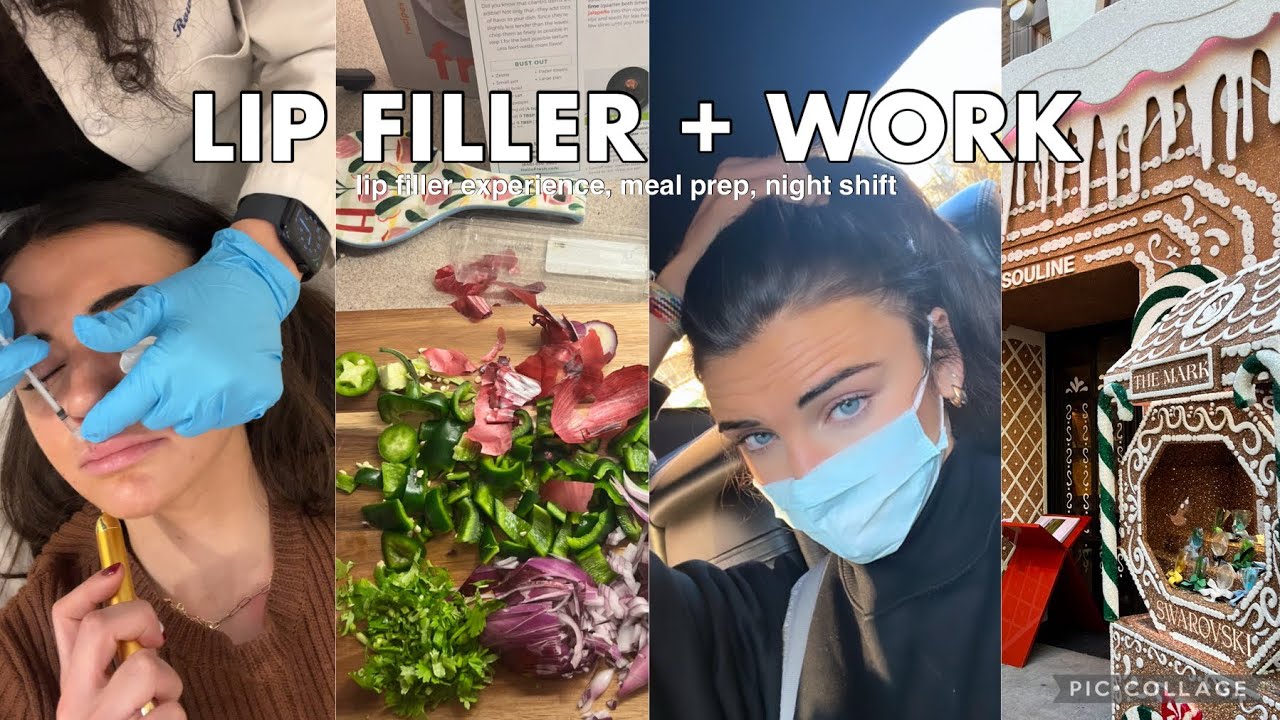 VLOGMAS 15 | getting lip filler, meal prepping, night shift