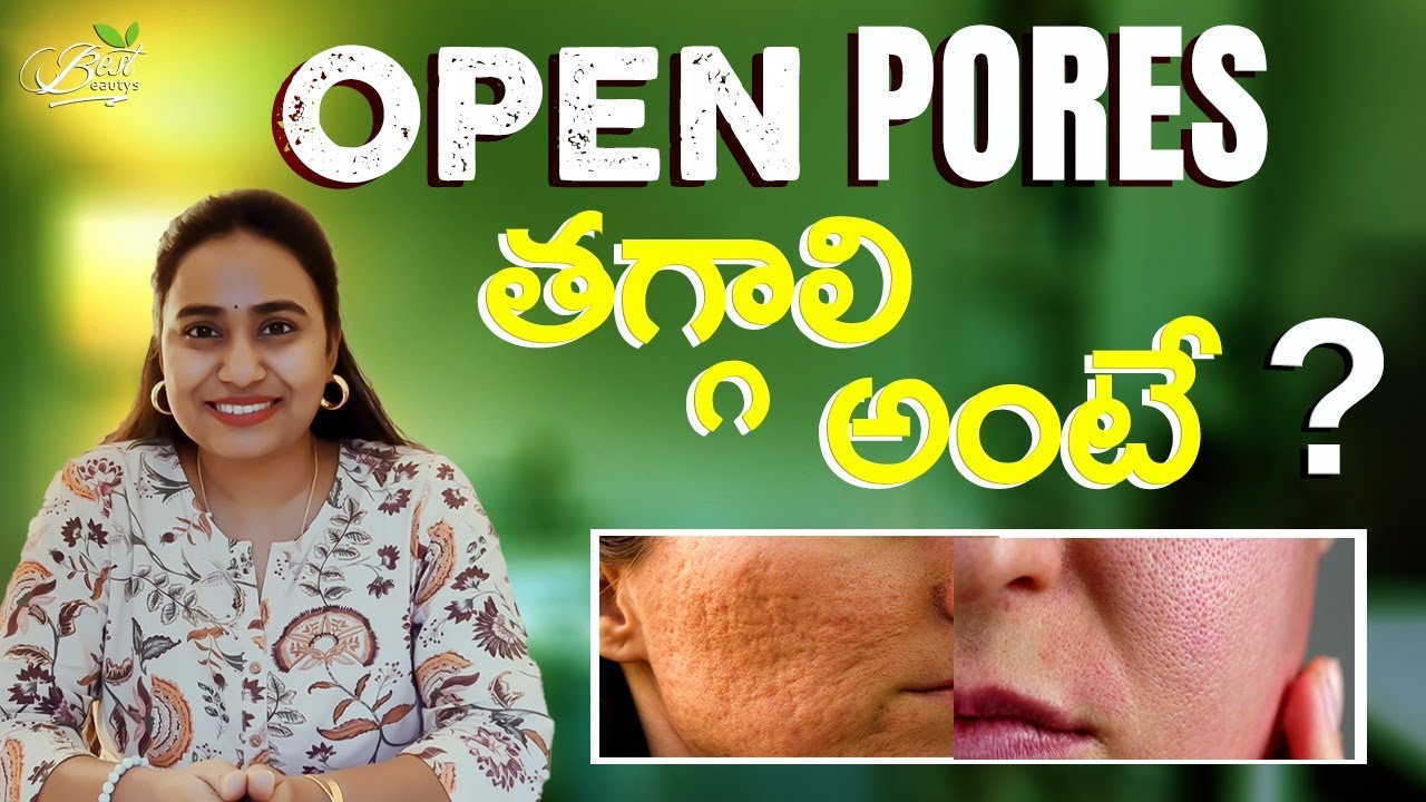 How To Reduce *Large Open Pores* In Telugu? | Best Beautys