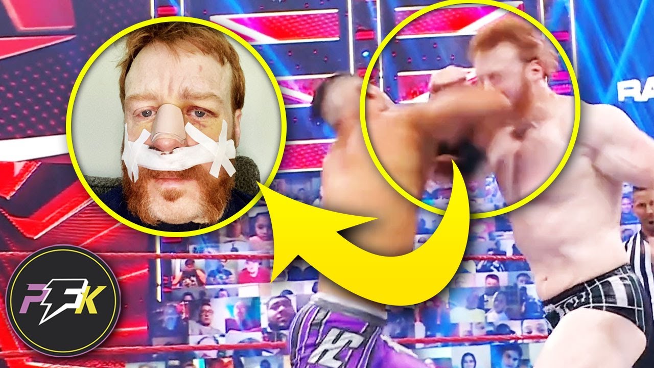 10 INSANE Injuries We Saw Happen LIVE in 2021