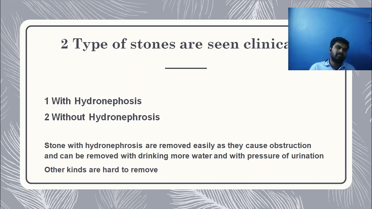 stone& its homoeopathic managment by dr manoj makani