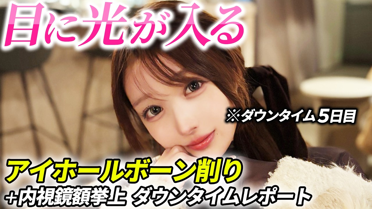 【アイホールボーン削り】奥目感を解消してバレずに垢抜け【内視鏡額挙上】