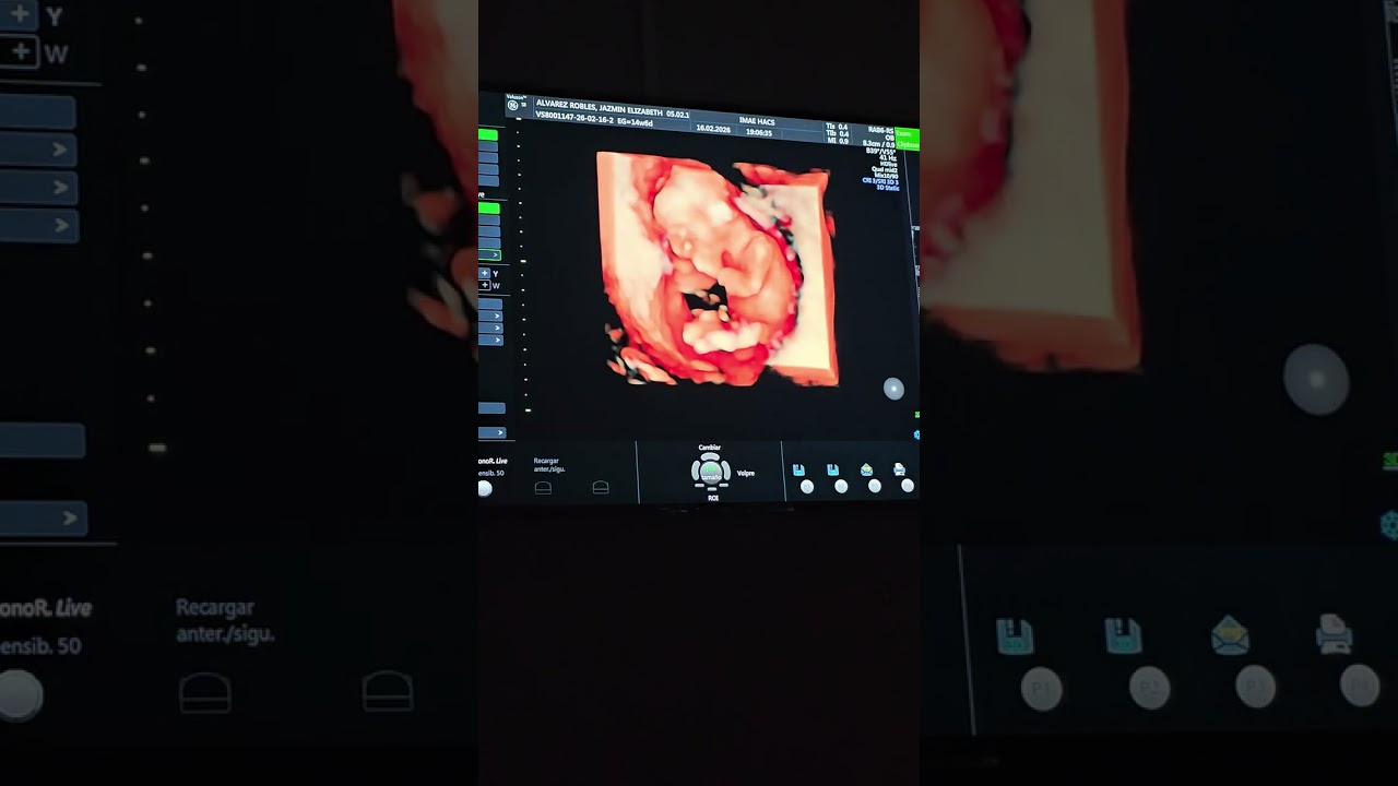 Nicolas Cuellar Alvarez Video 3