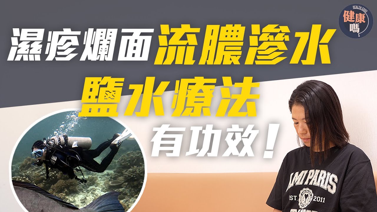 濕疹爛面流膿 中醫成功消炎穩定皮膚｜類固醇藥膏無益 削弱抗炎能力易復發｜1樣戶外活動對濕疹有幫助｜健康嗎@HealthCodeHK 【醫檔案】#濕疹 #中醫