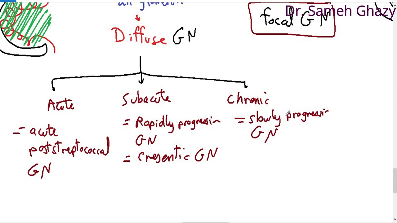 systemic pathology 48 : Urinary system 2  ( nephritic glomerulonephritis ) DR. SAMEH GHAZY