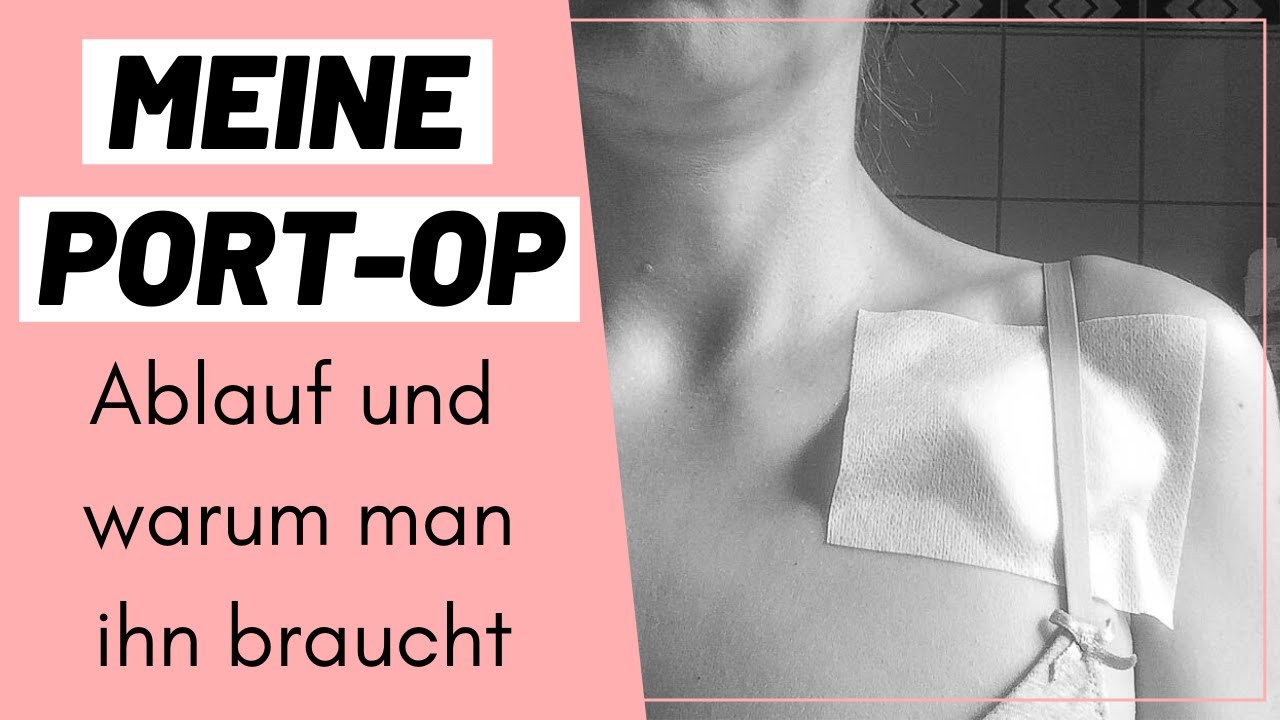 Meine Port-Operation: Ablauf und warum man ihn braucht | Chemotherapie |  Wyldest Life