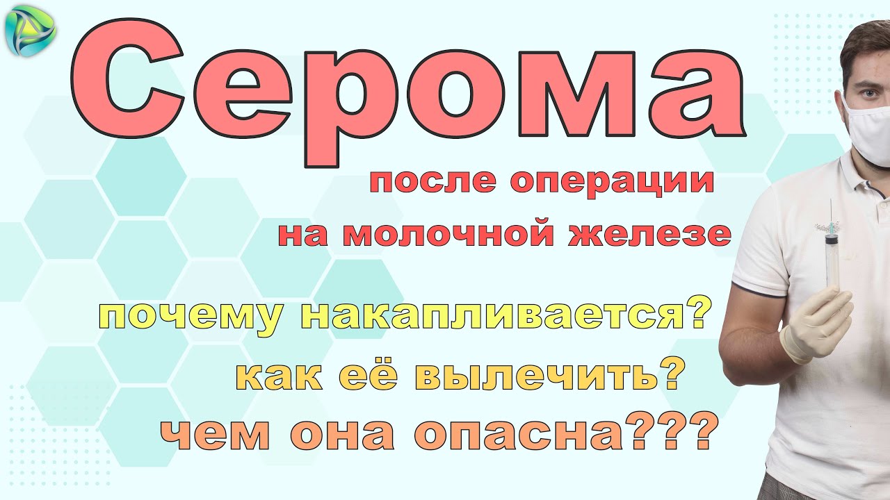 Серома после операции на молочной железе