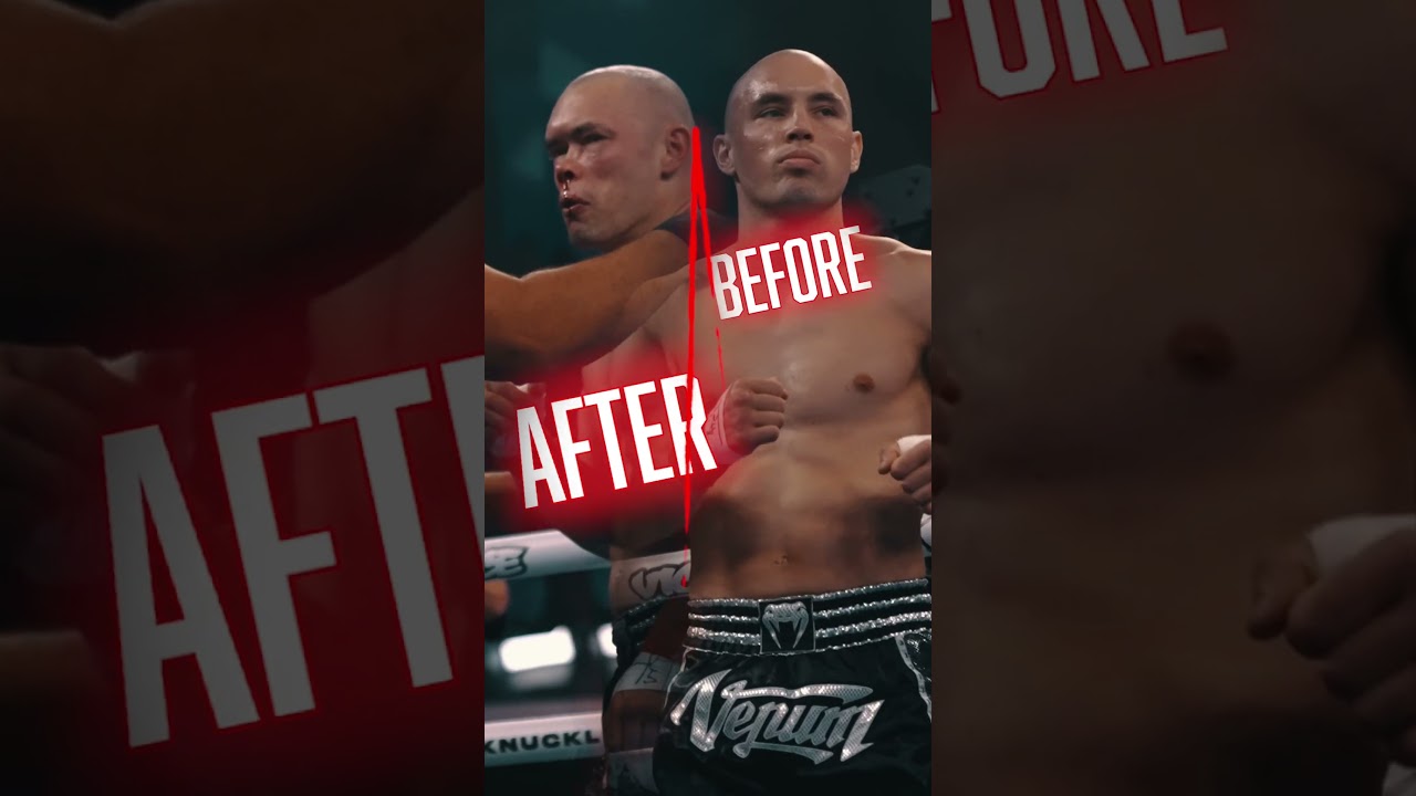 How Did This Short Punch Break His Nose?