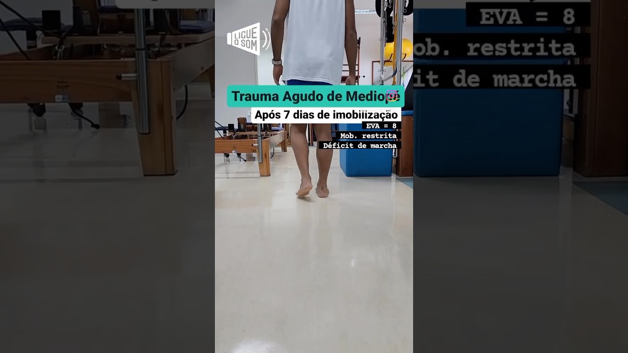 Eletroterapia no Trauma Agudo de Mediop&eacute;