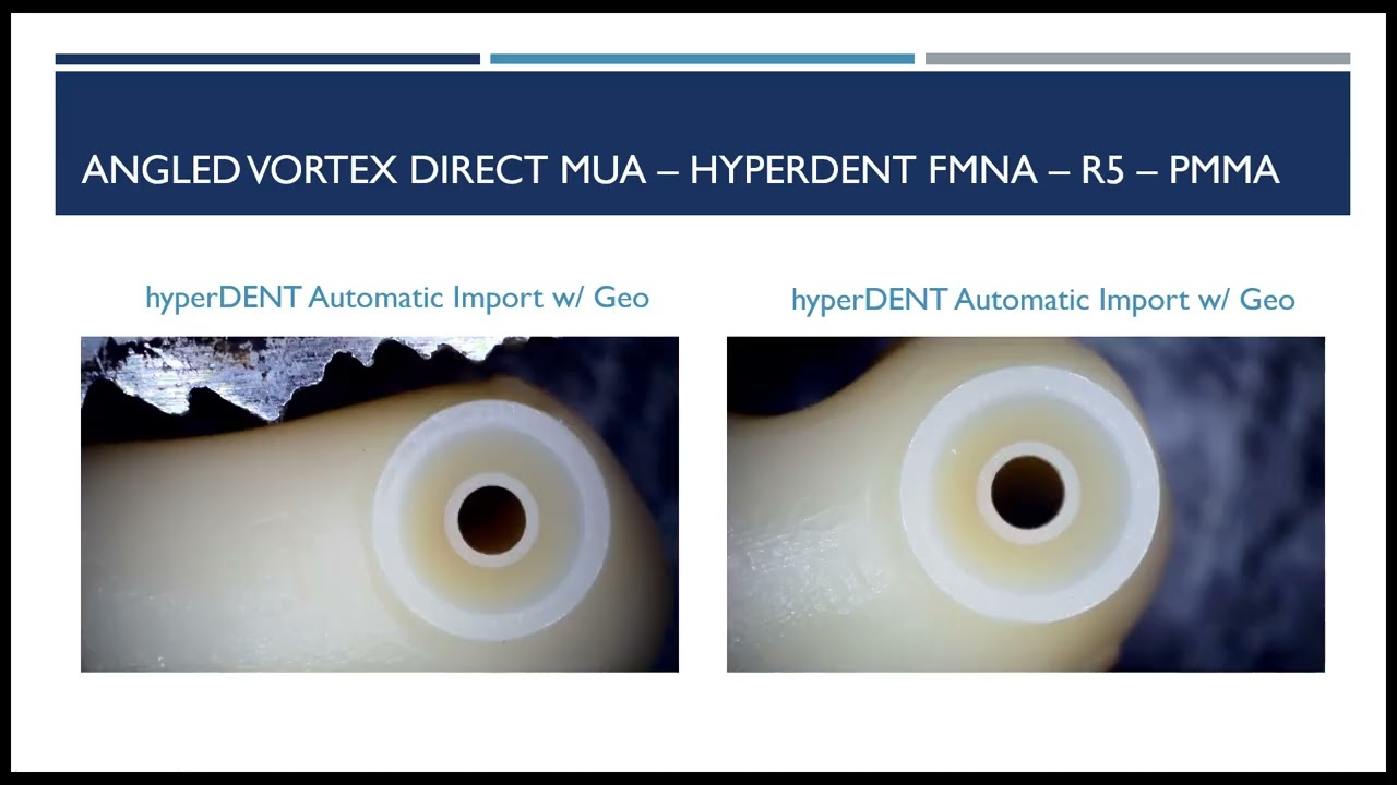 Vortex Screw Hyperdent VHF