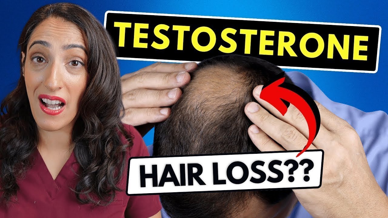 Will Testosterone Replacement Therapy (TRT) Make You Go Bald?